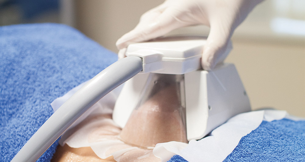 How Fat Freezing and HIFU Work Together? 2 Multiple Areas in One Session HIFU and Fat Freezing Surrey